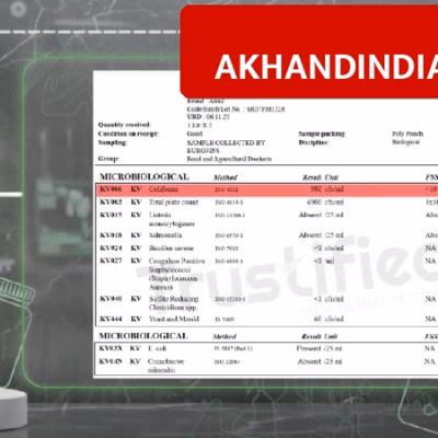 Amul and Mother Dairy Pouch Milk Fail Lab Test, Bacteria Count Exceeds Limit in New Report