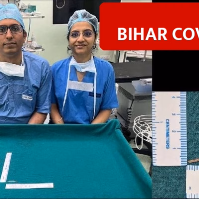 AIIMS Patna Doctors Remove 35mm Fish Bone From Patient Spine in 4 Hour Surgery